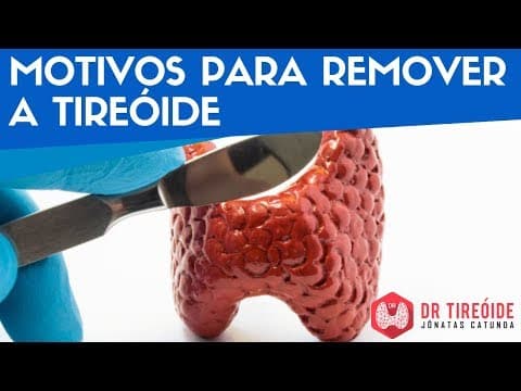 Motivos para remover a tireóide - Dr Tireóide Responde