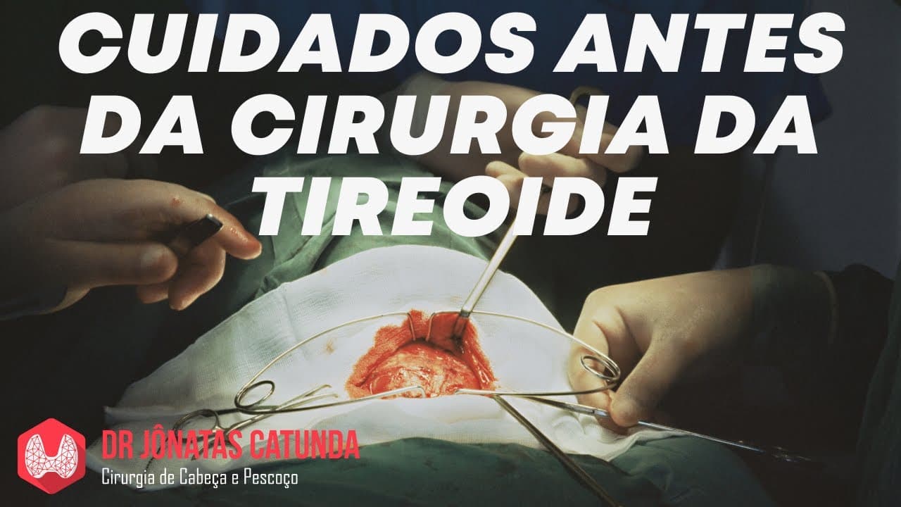O que fazer enquanto aguarda a cirurgia da tireoide?