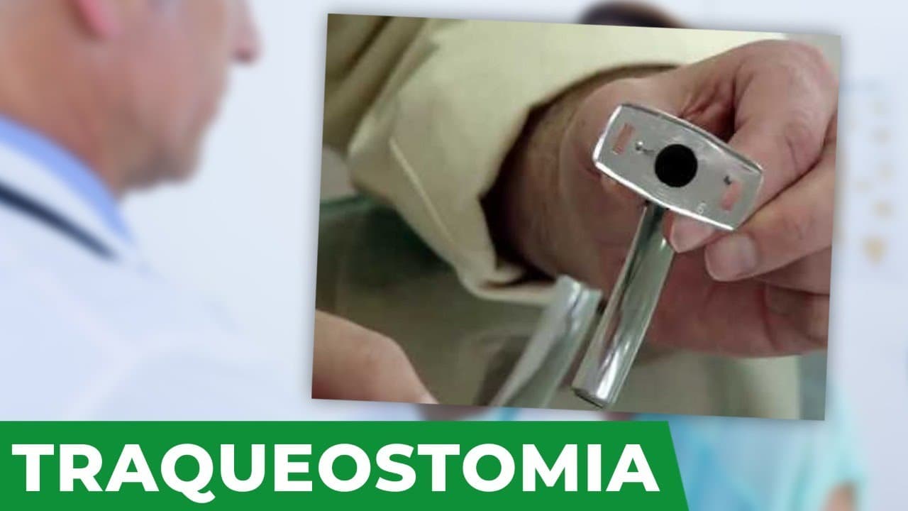 Traqueostomia no câncer de cabeça e pescoço