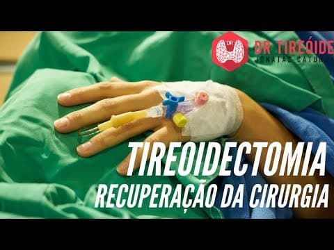 Como é a recuperação da tireoidectomia? | Dr Jônatas Catunda