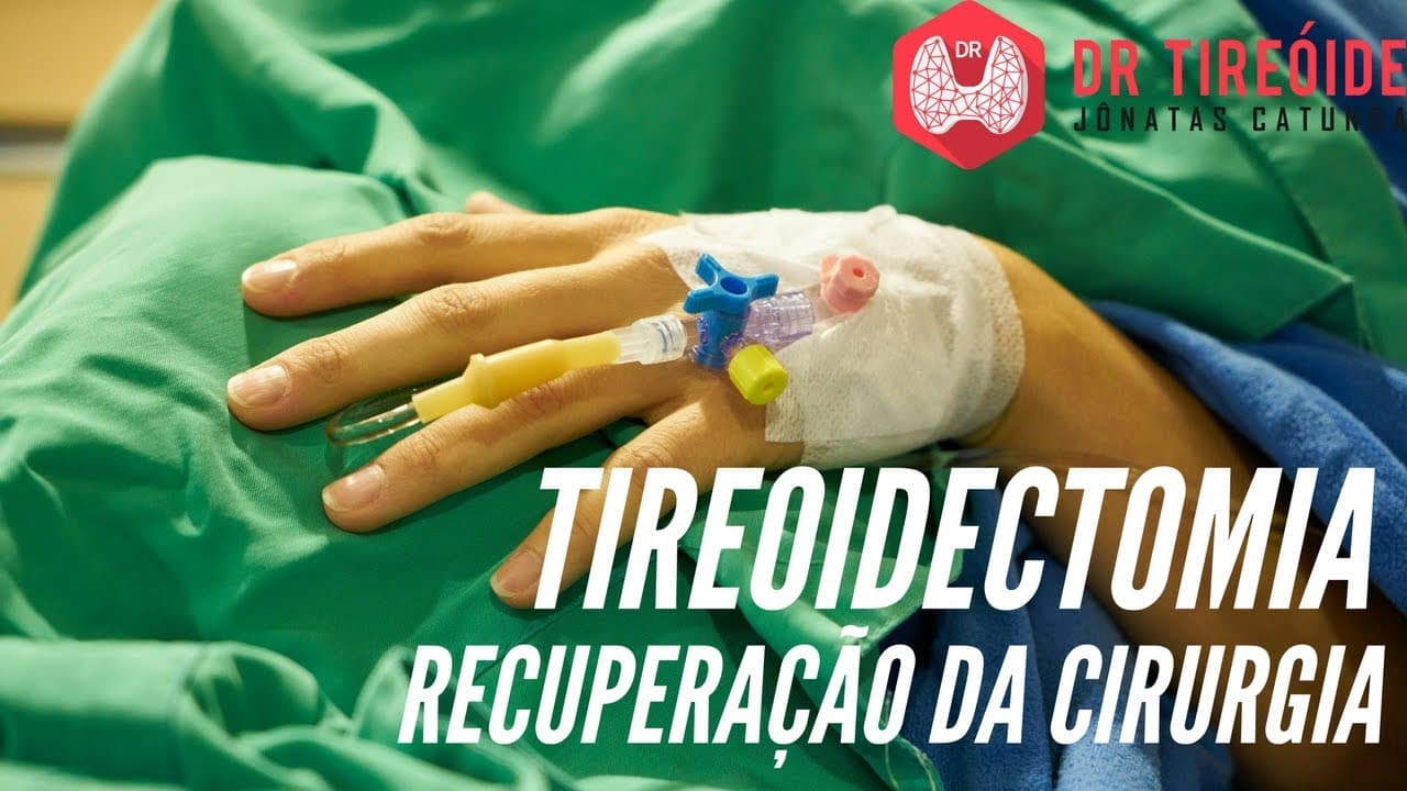 Como é a recuperação da tireoidectomia? | Dr Jônatas Catunda