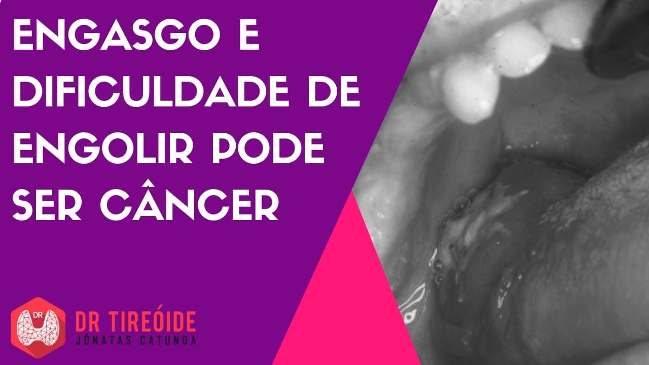 Engasgo e dificuldade de engolir podem ser sintomas do câncer!