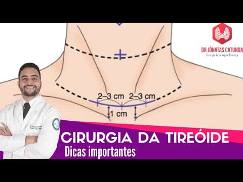Tireoidectomia - Dicas importantes! (anestesia, duração, drenos, cicatriz, complicações)