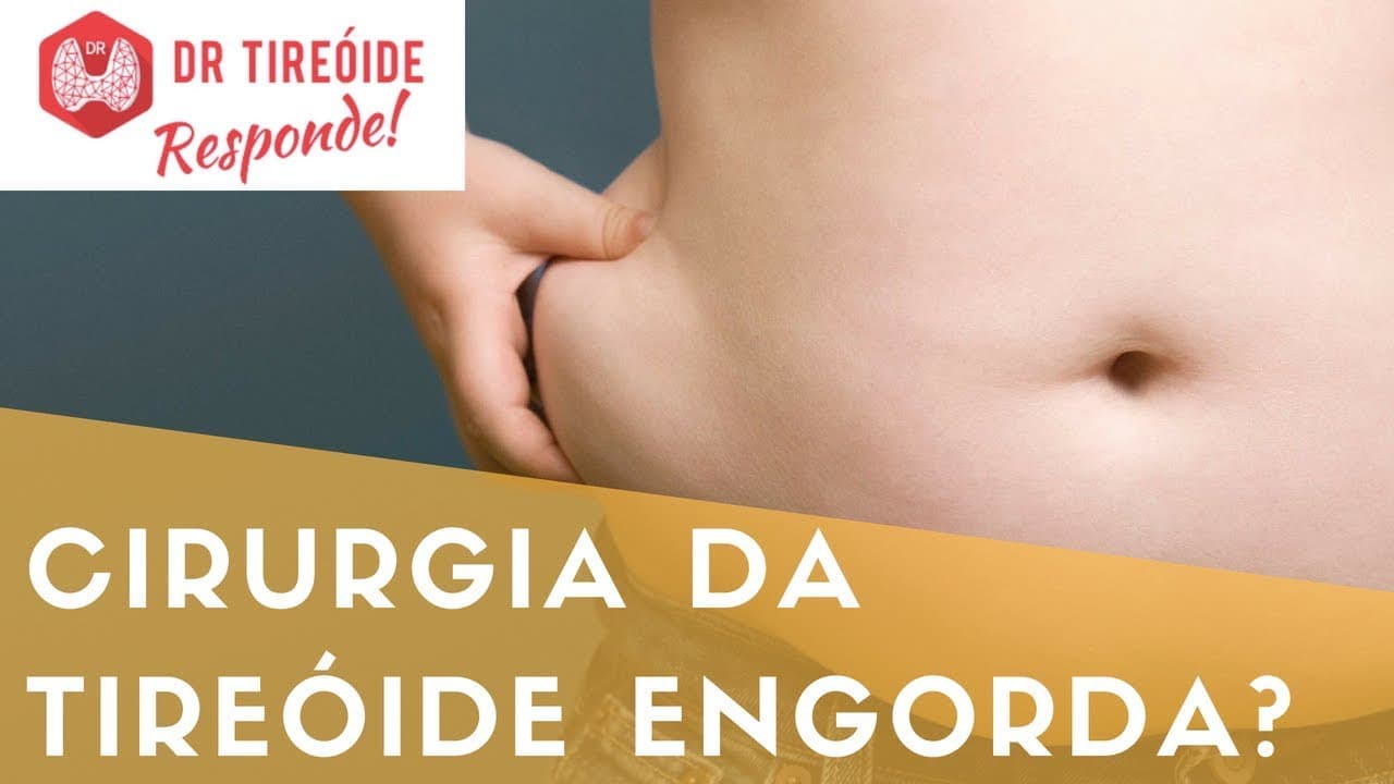 Cirurgia da tireóide engorda? - Dr Tireóide Responde