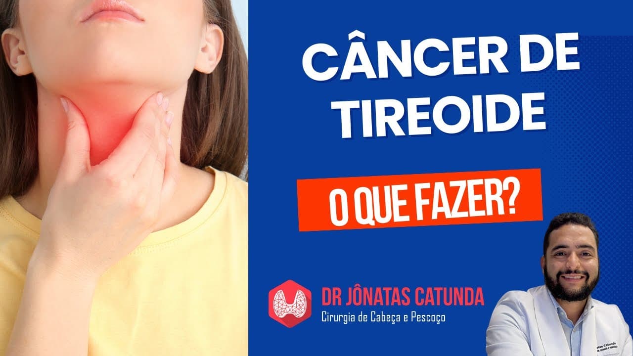 Câncer de tireoide na punção: o que fazer?