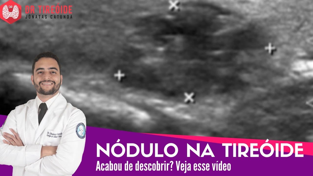 Nódulo na Tireóide - Vídeo para quem acabou de descobrir! | Dr Jônatas Catunda