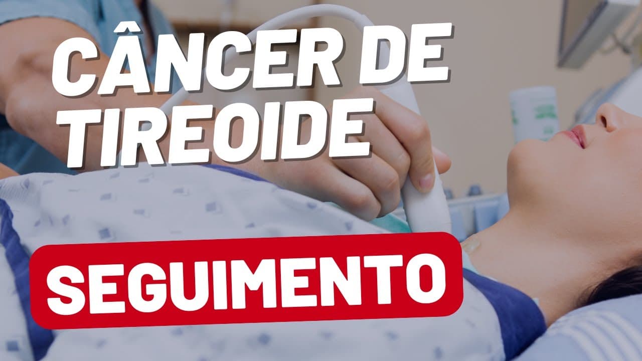 Seguimento do Câncer de Tireoide: Como Funciona