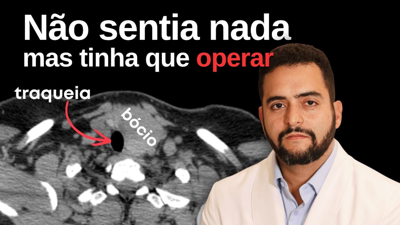 Não sentia nada, mas tinha que operar
