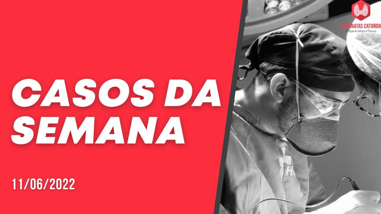 Casos da semana - câncer de tireoide, linfoma, câncer de pele, ablação por radiofrequência, toetva