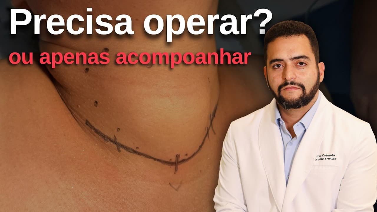 Nódulo na tireoide: quando é hora de operar?
