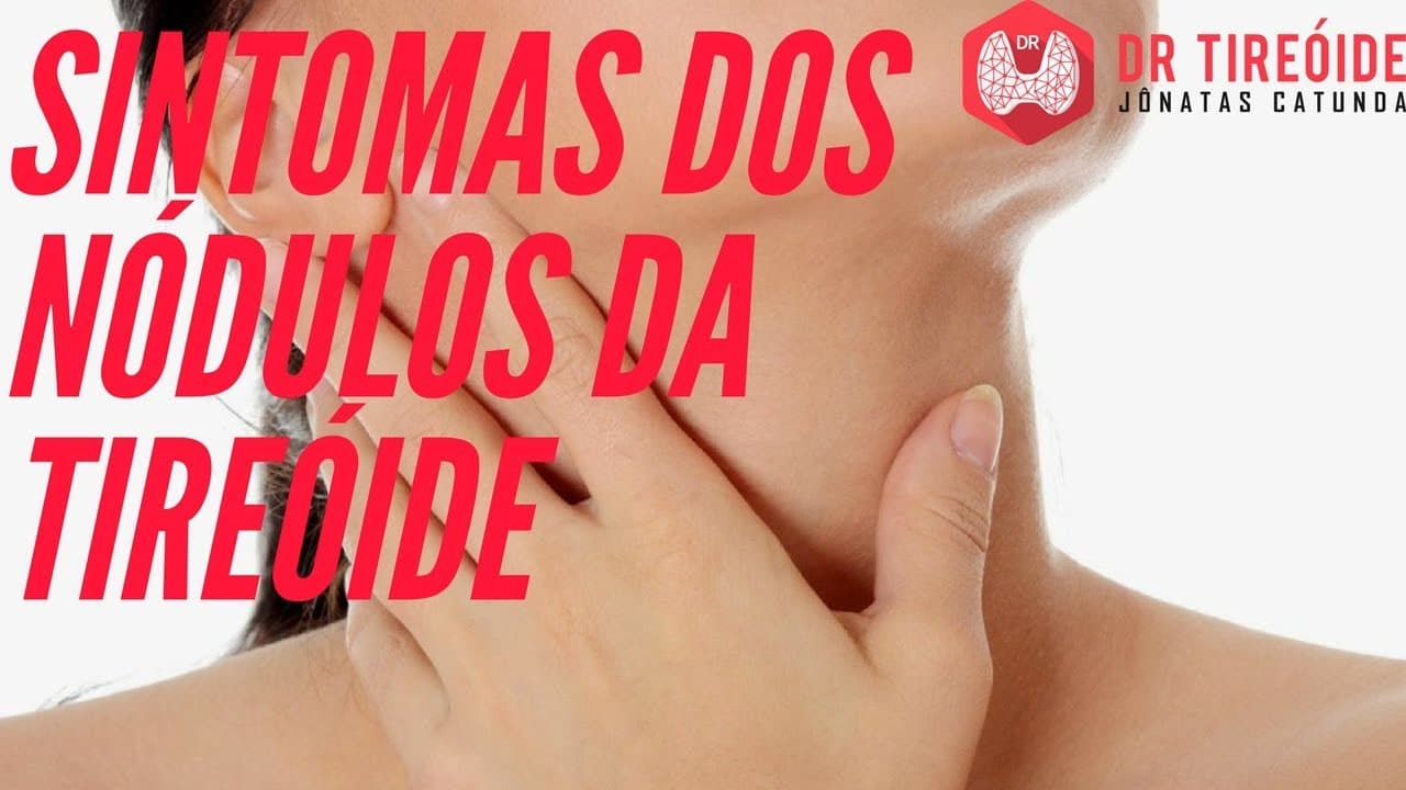 Sintomas dos nódulos da tireóide! | Dr Jônatas Catunda