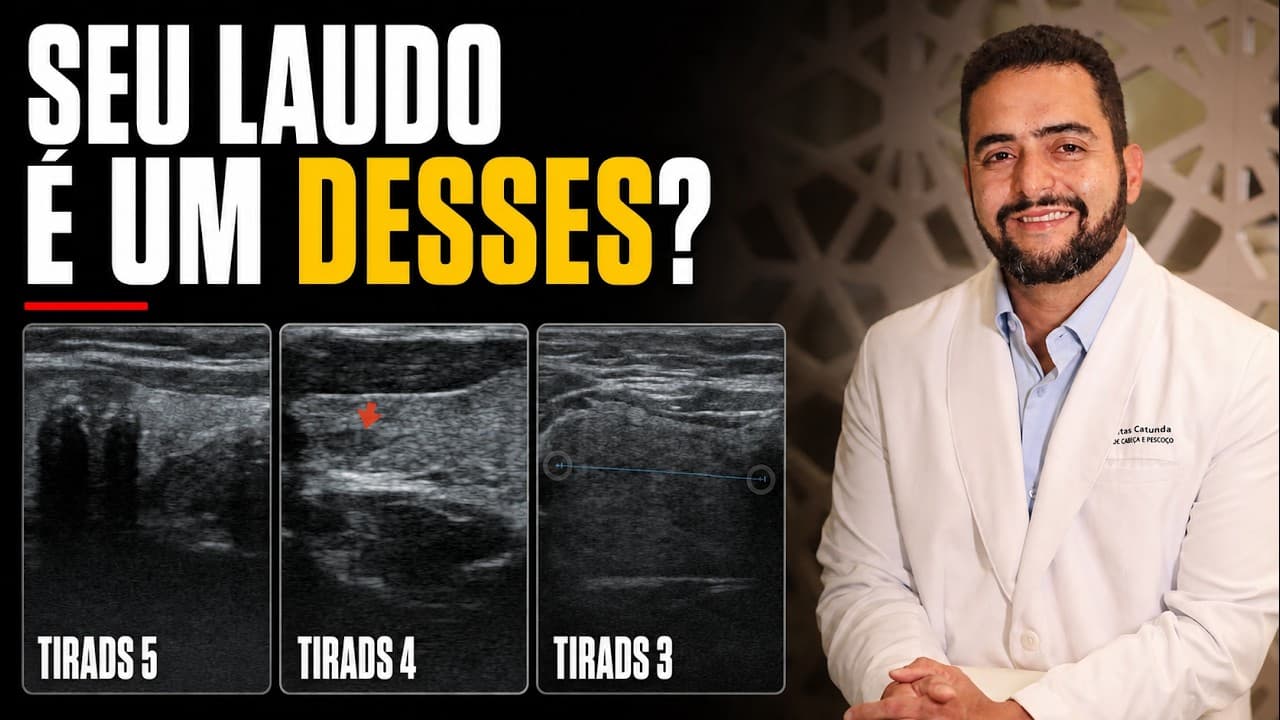 Qual TI-RADS é perigoso? Veja os nódulos que preocupam no ultrassom