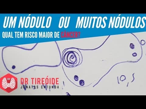 Nódulo único ou muitos nódulos - qual tem risco maior de câncer? - Dr Tireóide Responde