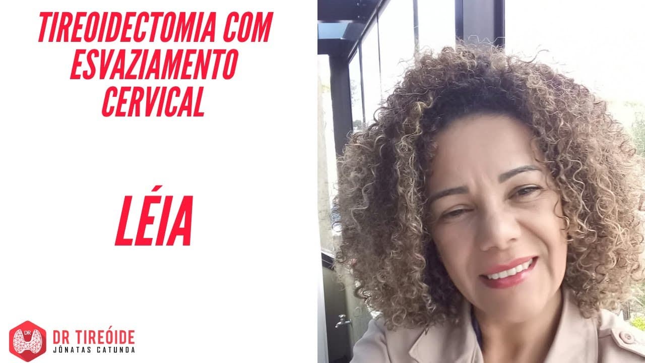 Tireoidectomia com esvaziamento cervical - Depoimento Léia - Tireóide e eu -