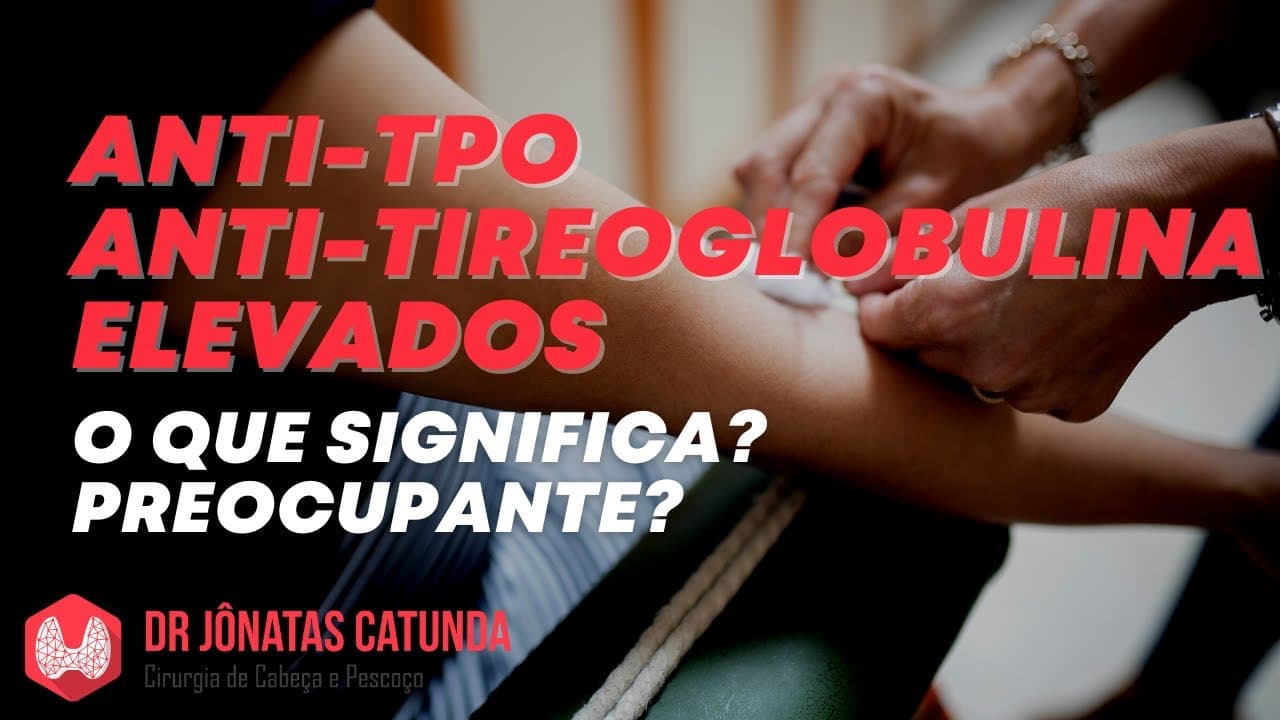 Anti-TPO e Anti-Tireoglobulina elevados: Tireoidite de Hashimoto