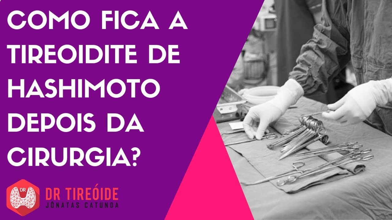 Como fica a Tireoidite de Hashimoto após a tireoidectomia?