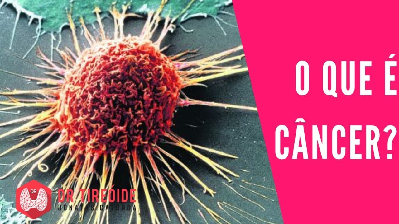 O que é câncer? | Dr Jônatas Catunda