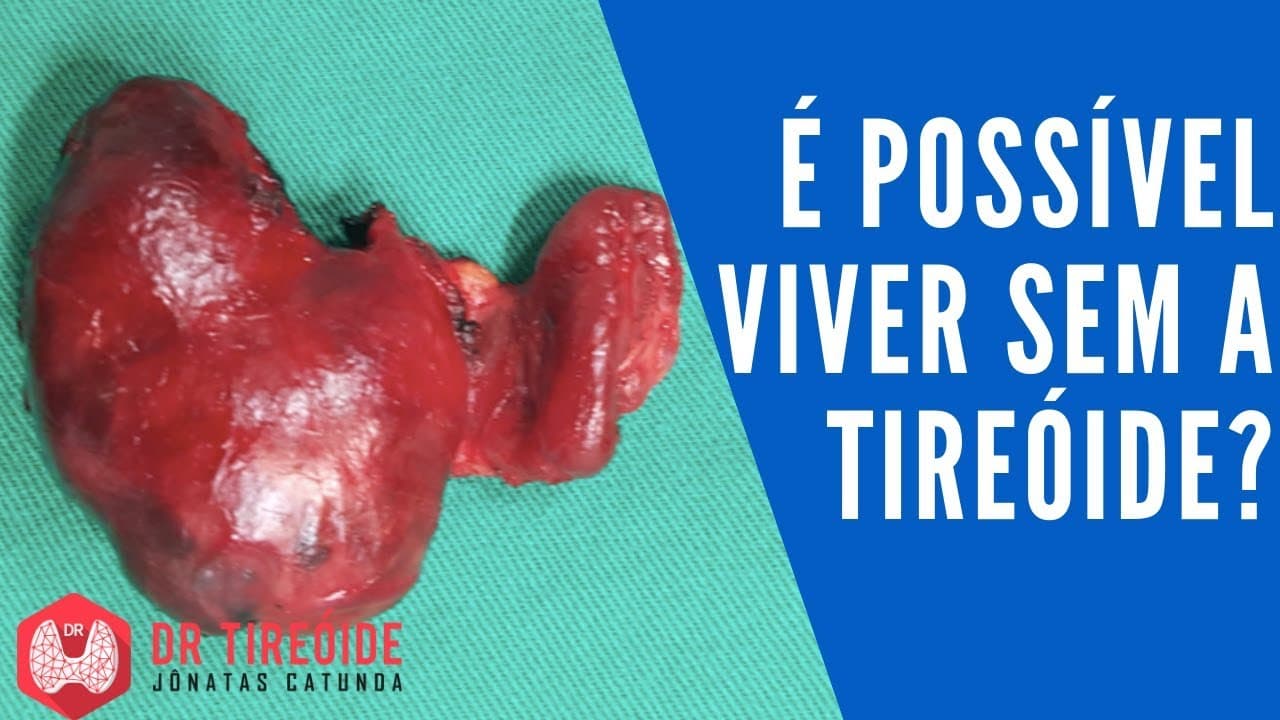 É possível viver sem a tireóide? - Dr Tireóide Responde