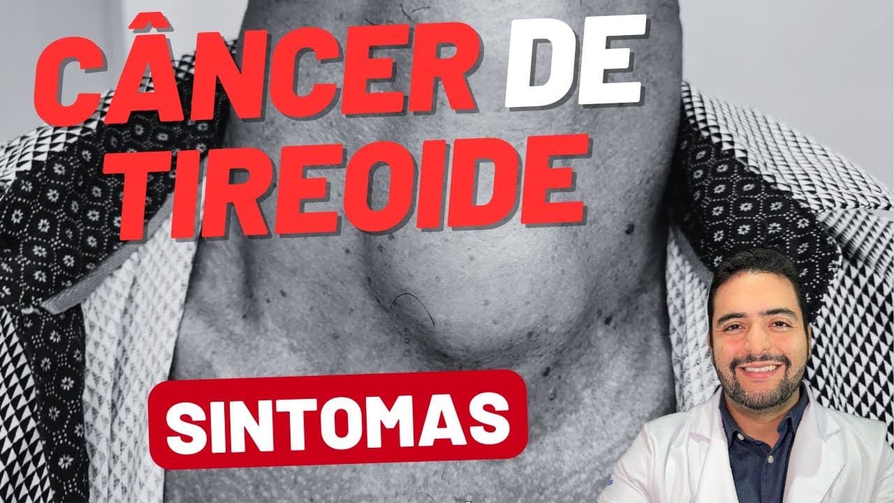 Câncer de Tireoide: Sintomas Que Você Precisa Conhecer!