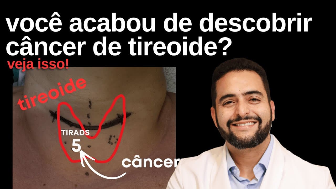 Você acabou de descobrir câncer de tireoide? Veja isso | LIVE com Dr. Jônatas Catunda
