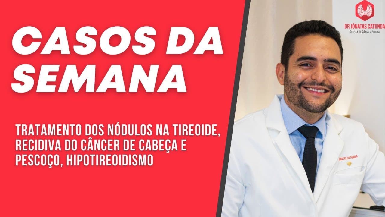 Casos da semana - Tratamento dos nódulos, câncer no pescoço, Hipotireoidismo e doenças associadas