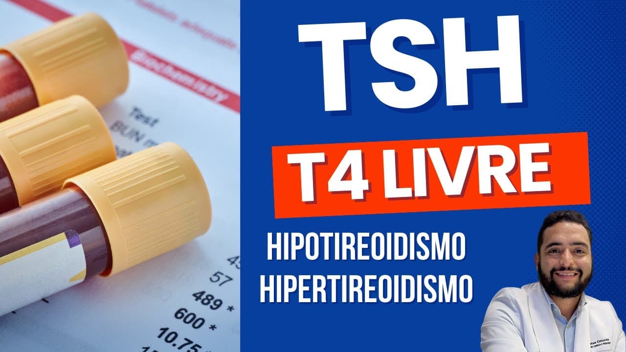 TSH e T4 livre - Hipotireoidismo e Hipertireoidismo