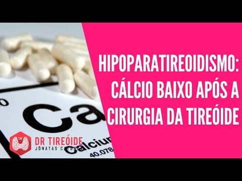 Hipoparatireoidismo: cálcio baixo após a cirurgia da tireóide | Dr Jônatas Catunda