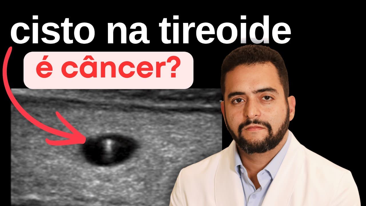 Cisto na tireoide pode virar câncer? Entenda a diferença entre cisto e nódulo