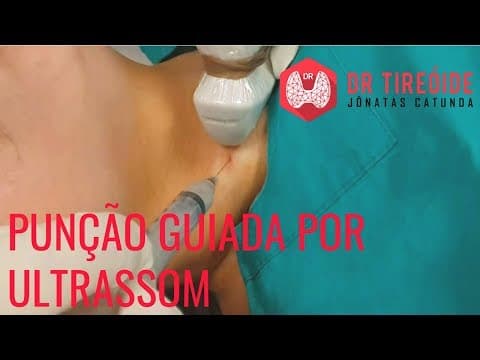 Punção guiada por ultrassom, a PAAF - Entenda como é feito essa biópsia!