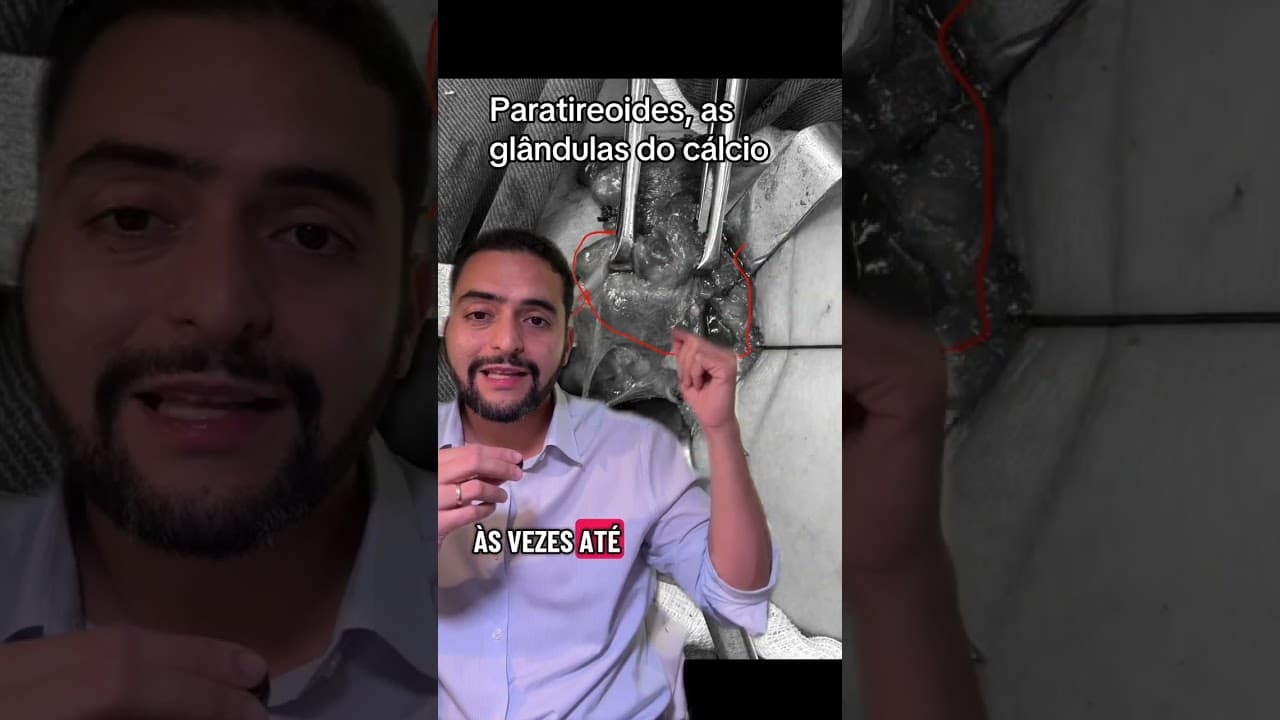 Cálcio baixo após cirurgia de tireoide: por que a mão formiga