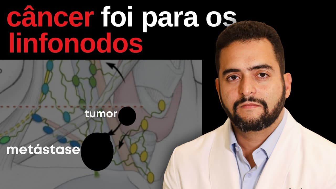 Metástase linfonodal no câncer de tireoide: é grave? Tem cura?