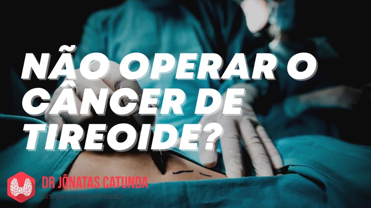 Câncer de tireoide - não operar, ficar acompanhando. Vigilância ativa