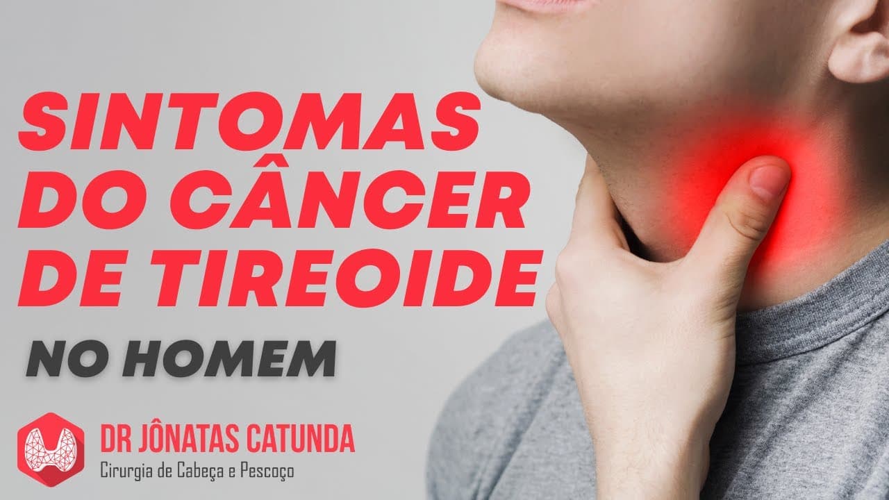 Sintomas do câncer de tireoide no homem