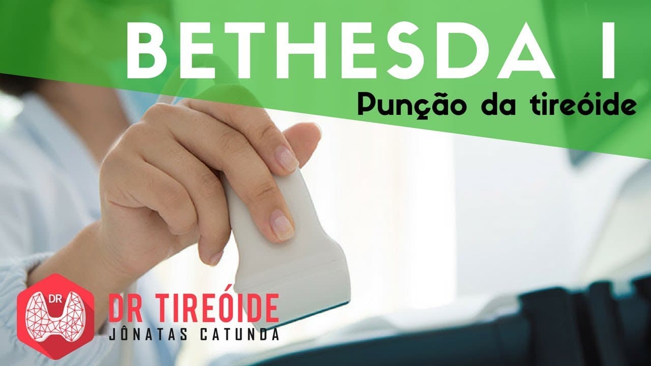 PAAF da tireóide Bethesda I - Material insatisfatório | Dr Jônatas Catunda