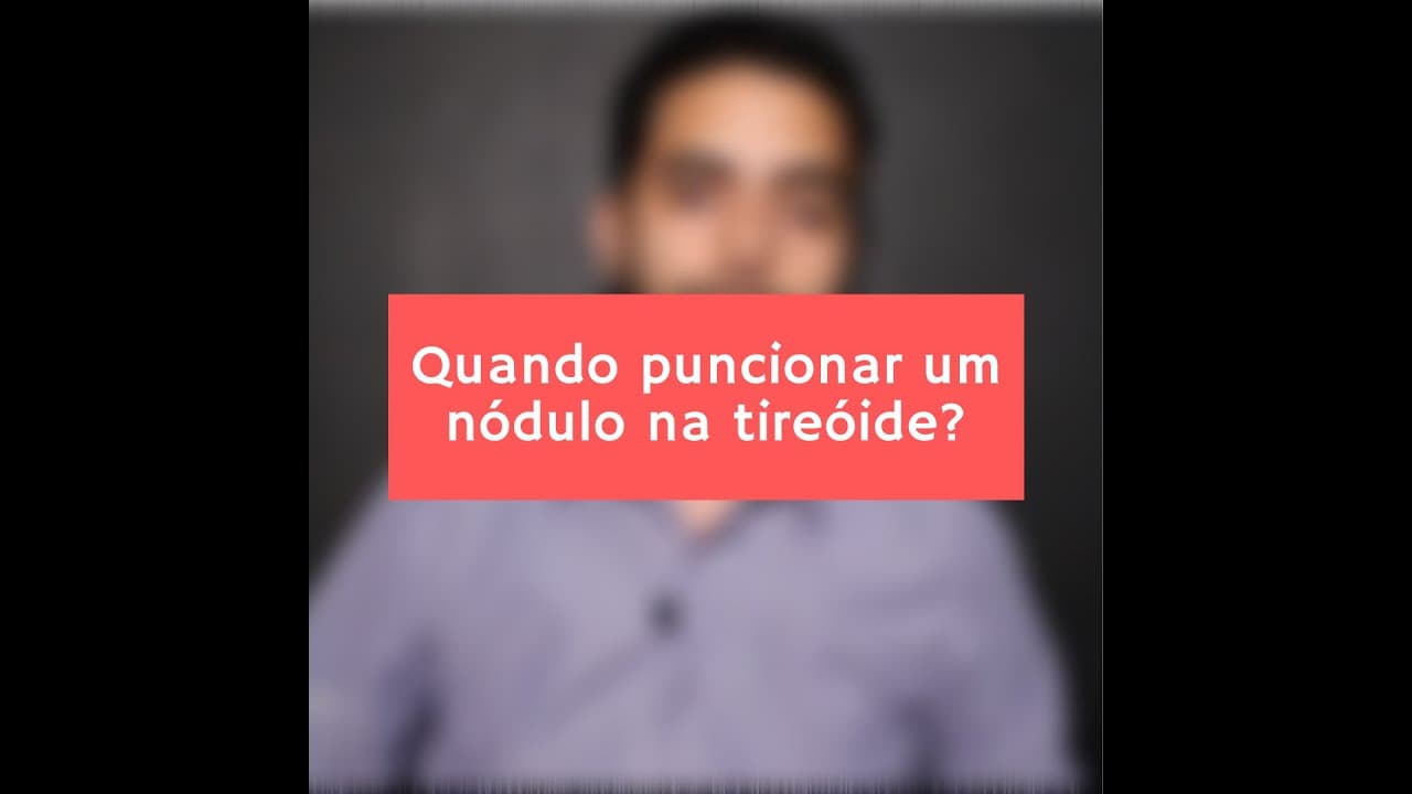 Quando puncionar um nódulo na tireóide
