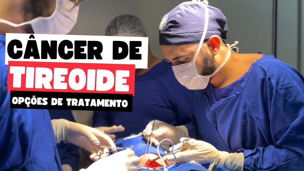Opções de Tratamento para o Câncer de Tireoide: Melhor caminho para a Cura