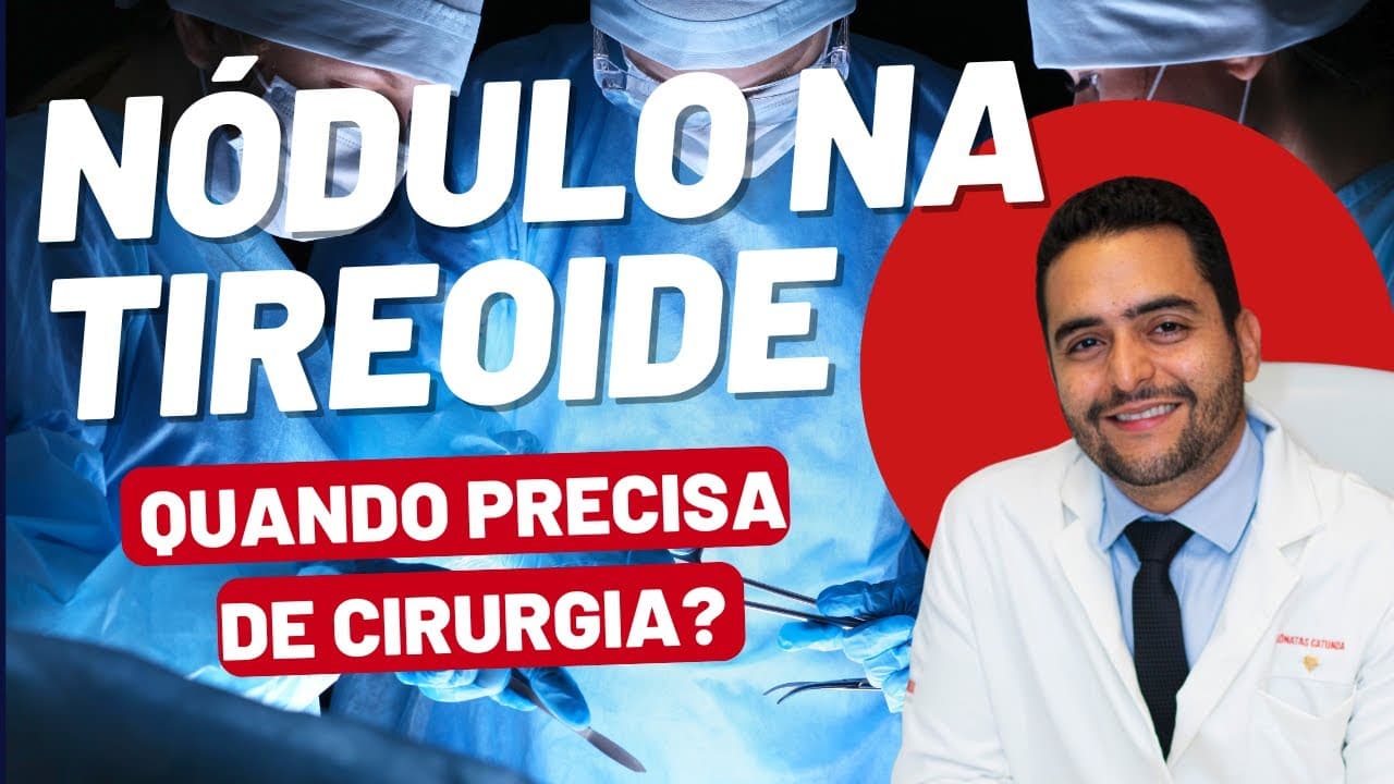 Nódulos na Tireoide: Quando precisa de cirurgia?