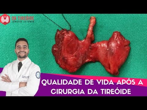 Existe qualidade de vida após a cirurgia da tireóide?