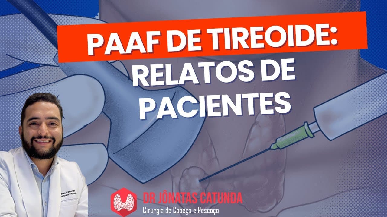 PAAF - punção de nódulo na tireoide - Comentando os comentários do instagram