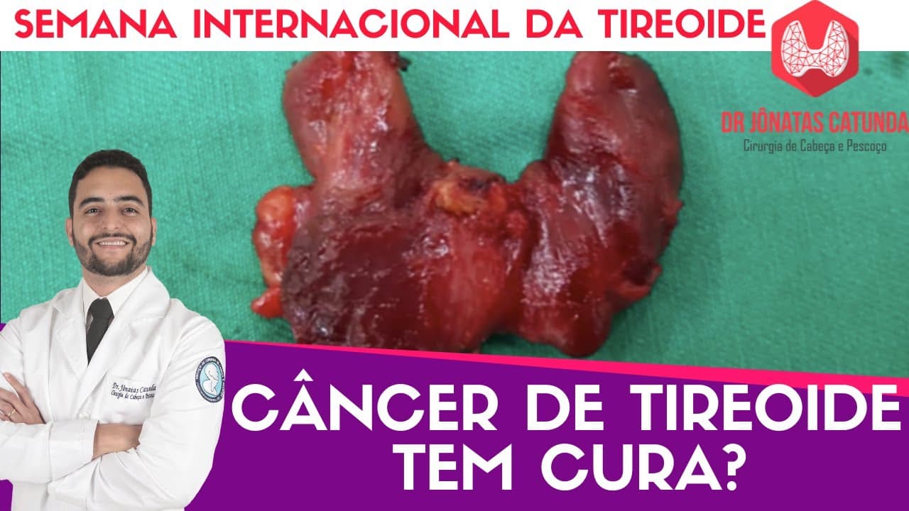 Câncer tireoide tem cura? - Semana internacional da tireoide