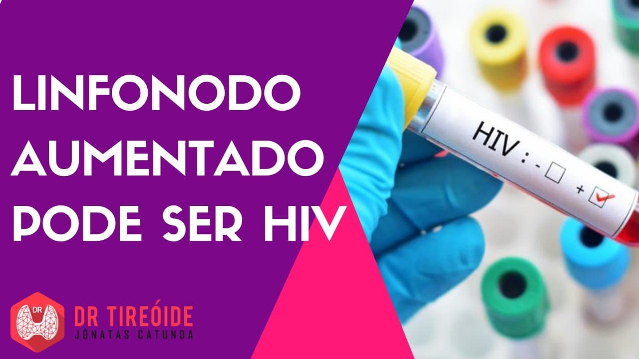 Linfonodo aumentado pode ser sinal de HIV?