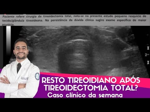 Resto tireoidiano após a tireoidectomia total - Caso clínico da semana