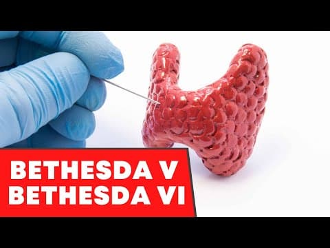 Resultados Bethesda V ou VI na punção de tireoide - É câncer? Tem tratamento?