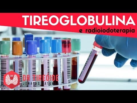 Tireoglobulina e radioiodoterapia - Dr Tireóide Responde