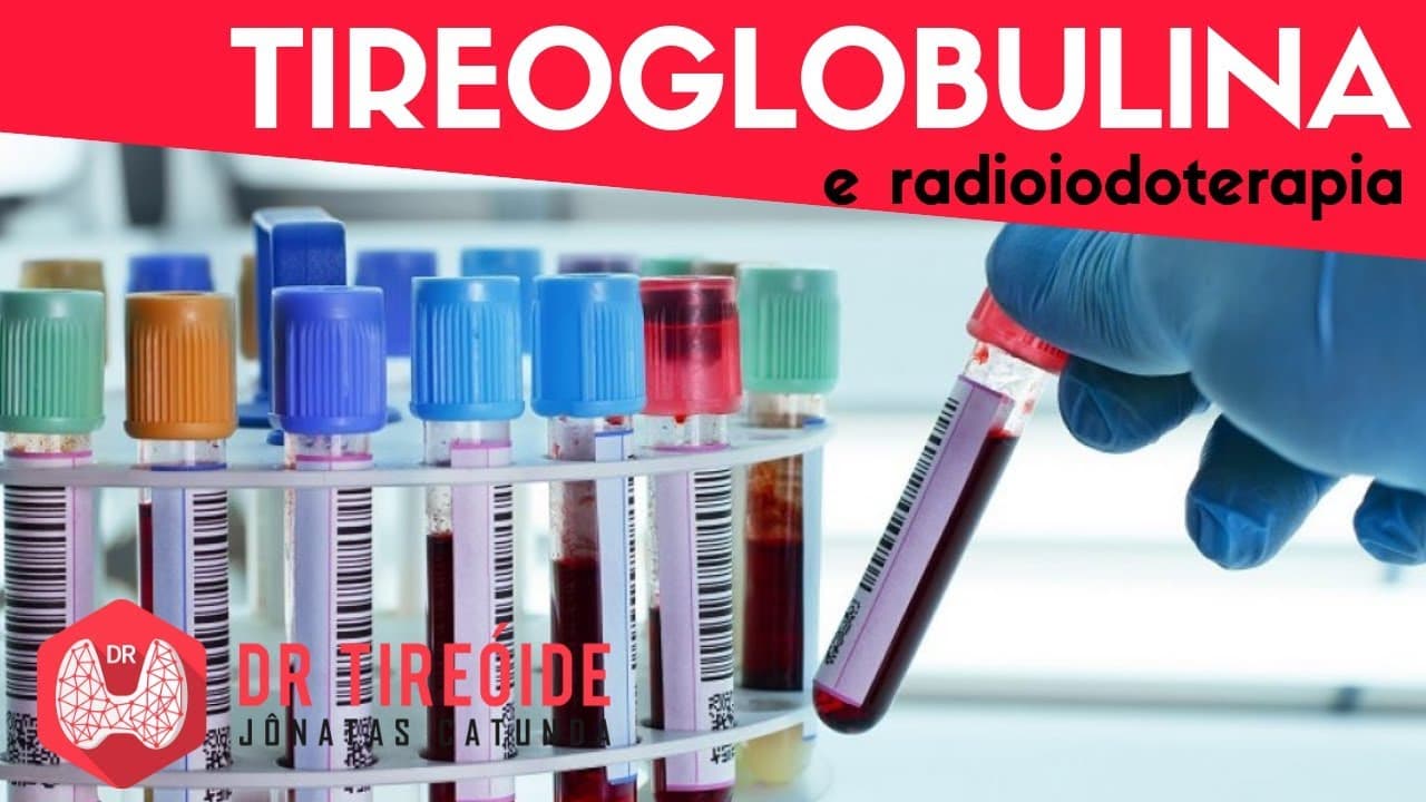 Tireoglobulina e radioiodoterapia - Dr Tireóide Responde
