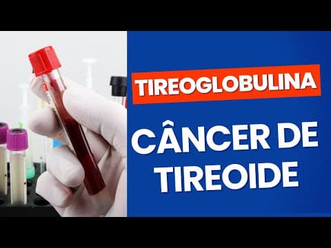 Tireoglobulina no seguimento do câncer