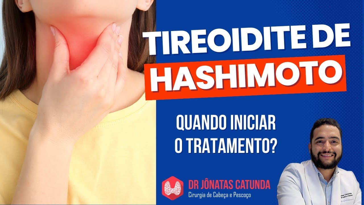 Tireoidite de Hashimoto: Quando iniciar o tratamento?