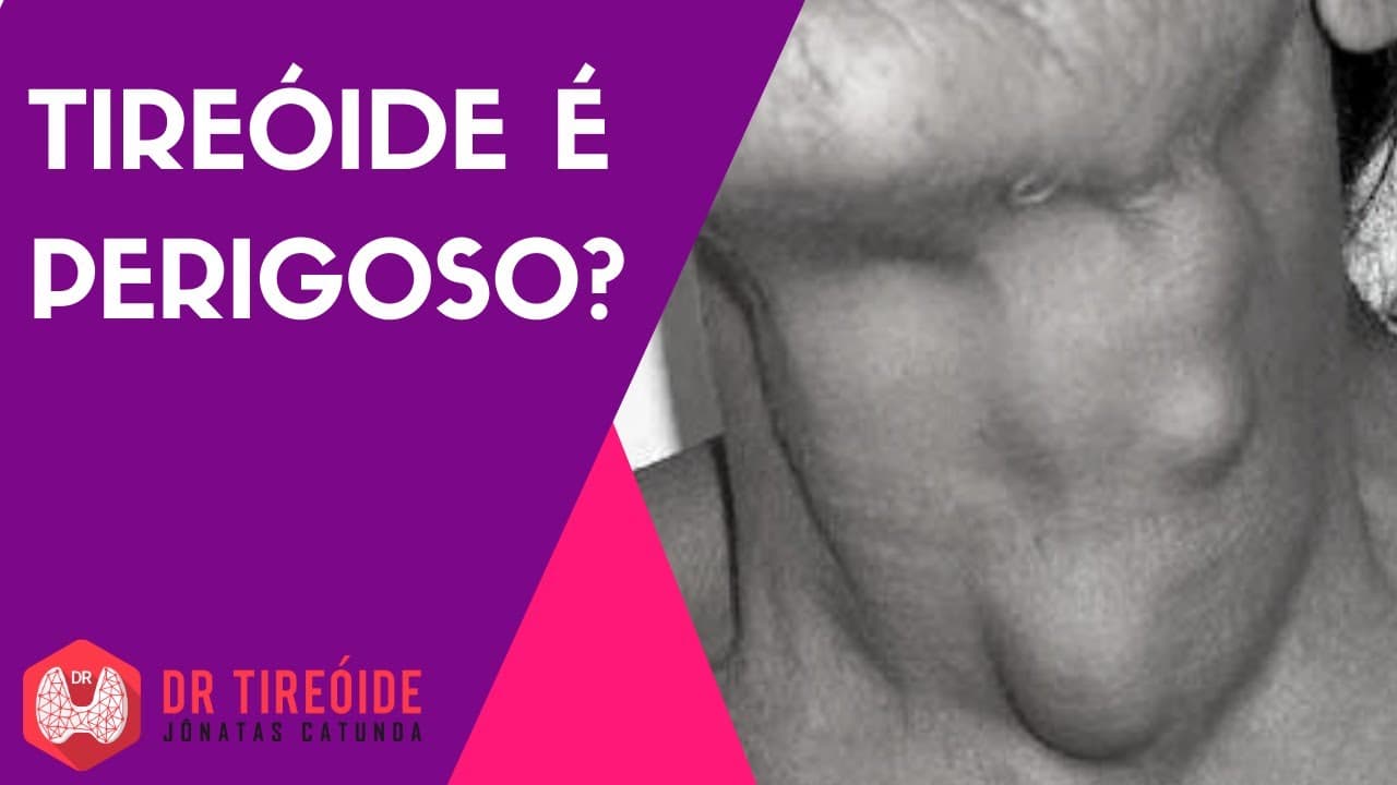 Tireóide é perigoso? | Dr Jônatas Catunda
