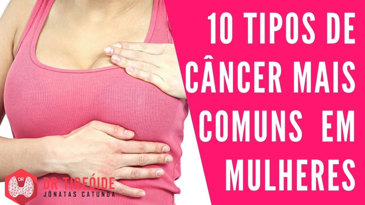 10 tipos de Câncer mais comuns em mulheres | Dr Jônatas Catunda
