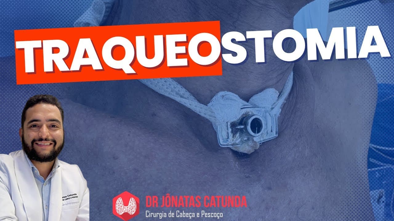 Traqueostomia - indicações, riscos, complicações